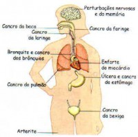 /album/combate-ao-tabagismo/imagem1-jpg/